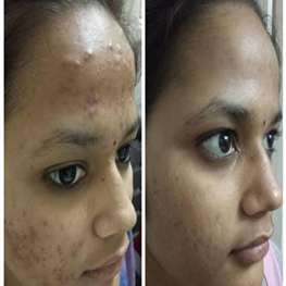 herbal-pure-product-9